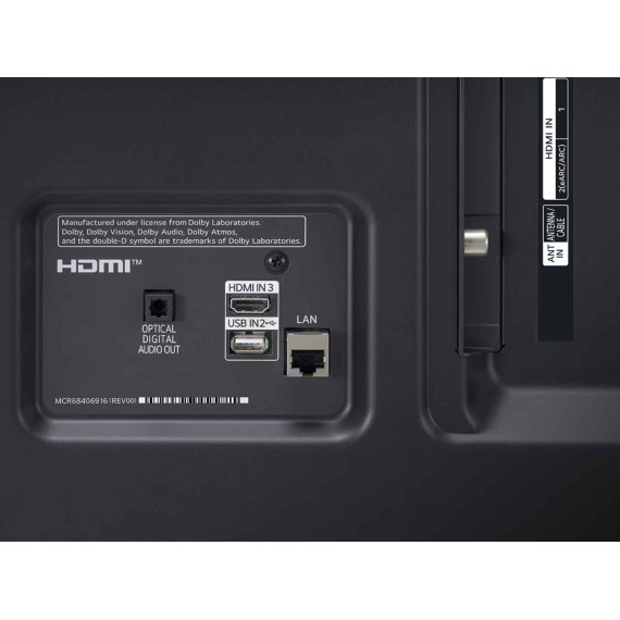 Հեռուստացույց LG 75UT81006LA 